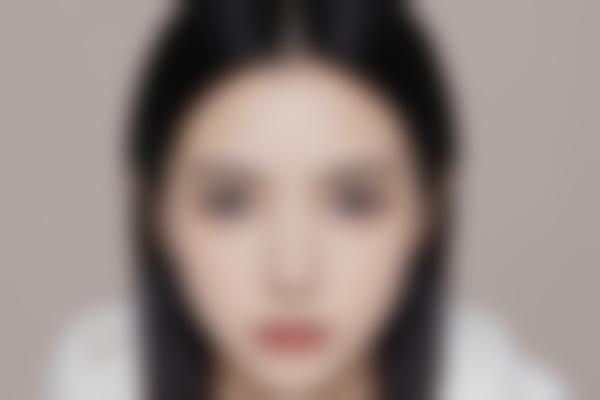 射频美容如何？北京华臣医疗美容射频美容项目介绍
