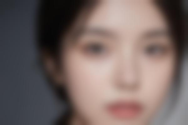 去眼袋哪里做得好以及大概需要多少钱