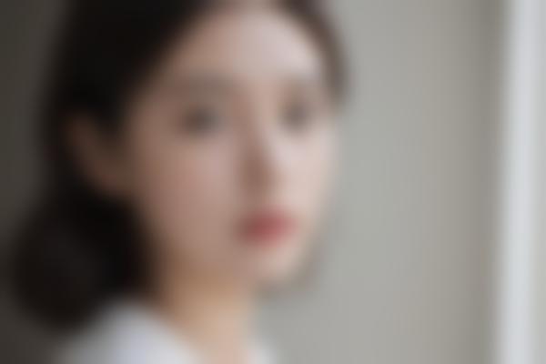 青岛色素病变治疗哪里好？青岛色素病变医院精选盘点