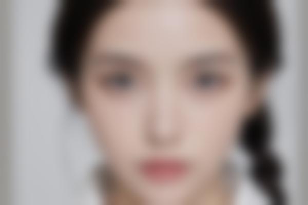 福州去眼袋哪家医院好？这几家正规机构值得一看