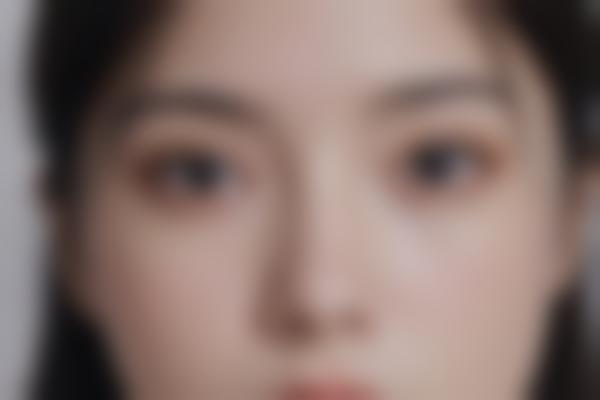 西安湿疹治疗与护理全攻略