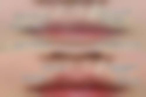 韩国Bustium整形外科口碑评价与项目分享：