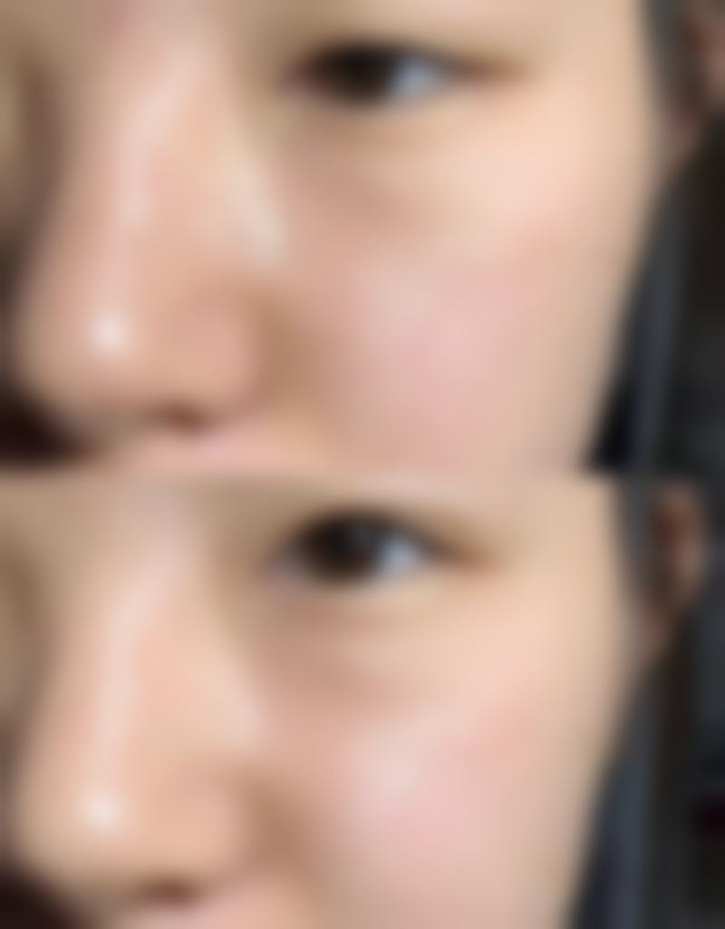 韩国Bustium整形外科车秉勋医生预约挂号