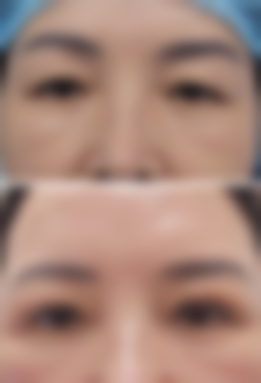 博乐美若星辰整形医院收费价格表