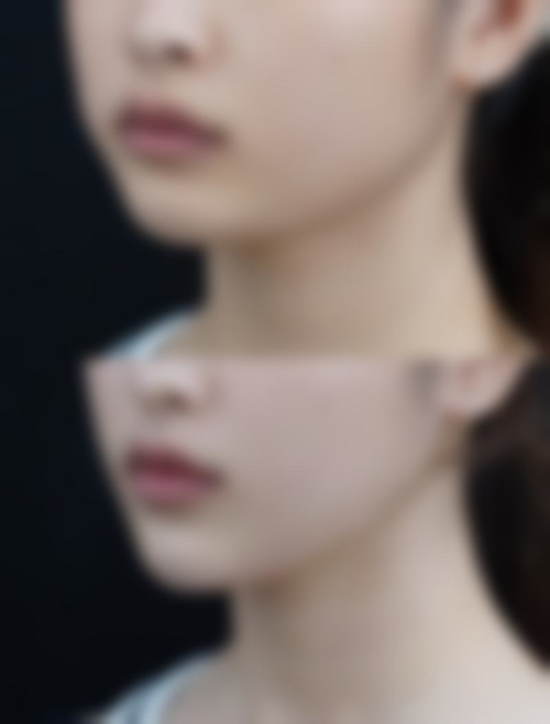 邢台臻悦医疗美容门诊部口碑评价与项目分享：