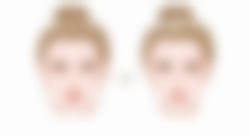 商丘冰之薇整形医院项目优势明显。