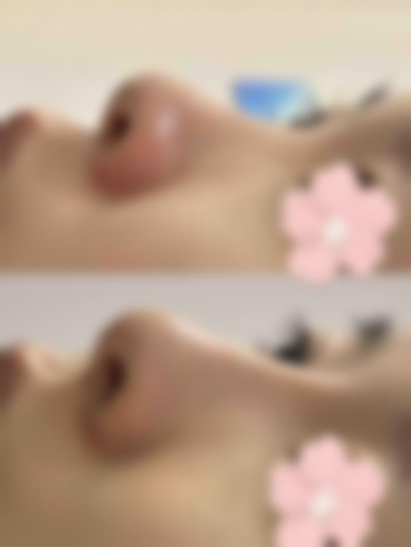 南宁雍禾植发医疗美容门诊部治疗反馈与口碑评价。