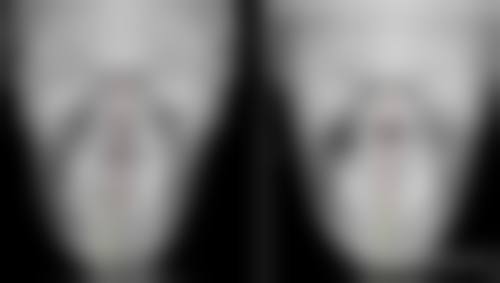  陈家欢医生技术怎么样