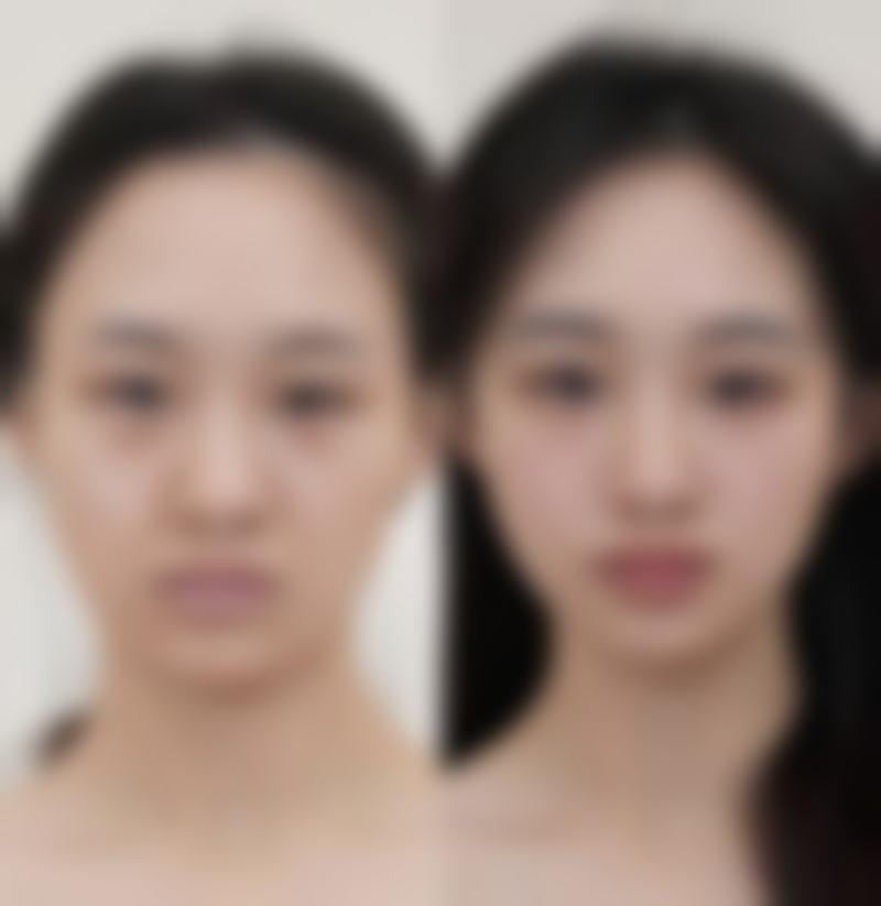 西安莎曼妃整形医疗美容医院擅长项目