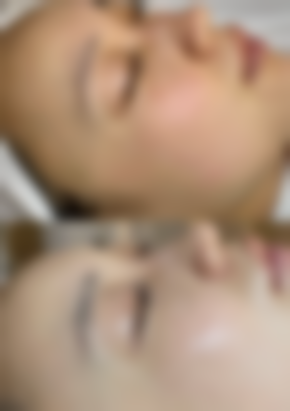 陈家欢医生的技术与实力