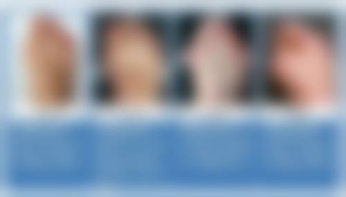 广州市第十二人民医院何荣国医生口碑评价与项目分享：