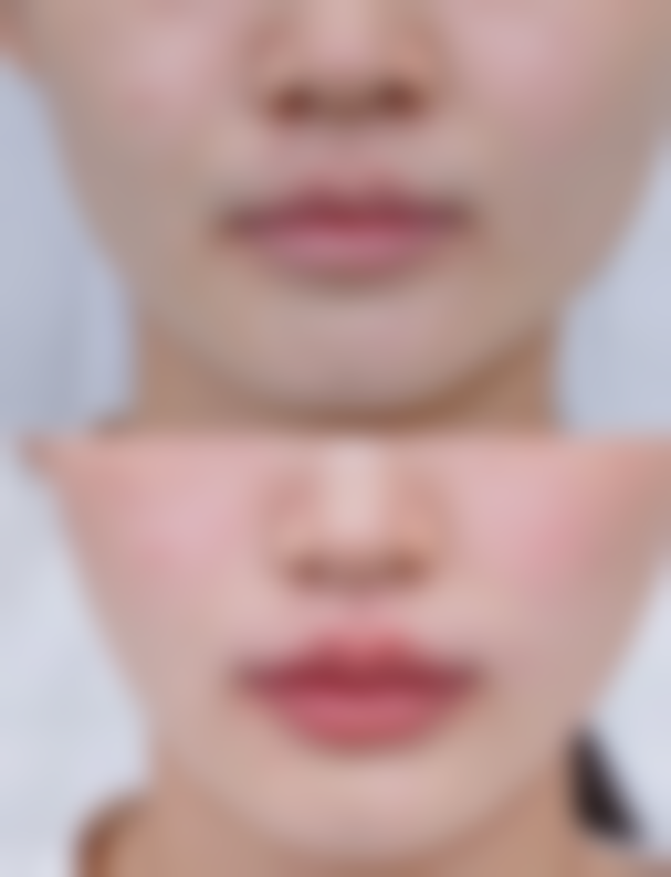 平顶山汝州仁爱医院预约挂号方式