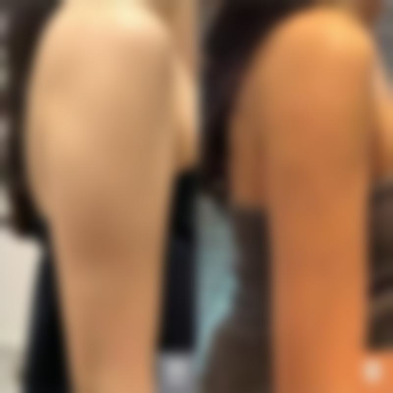 珠海美南华医疗美容收费价格表