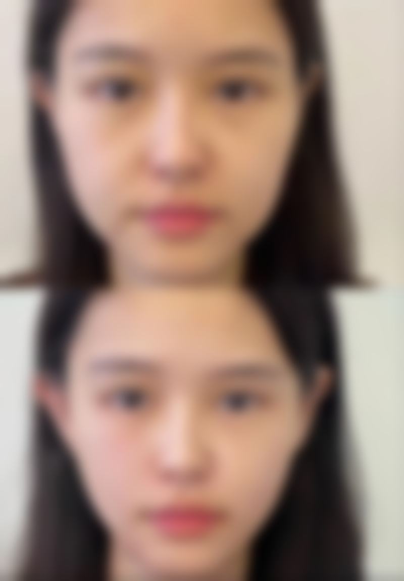 陈家欢医生口碑评价与项目分享: