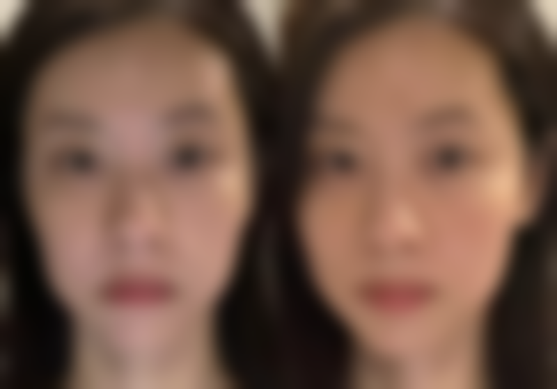 蚌埠韩美美莱医疗美容门诊部治疗反馈与口碑评价。