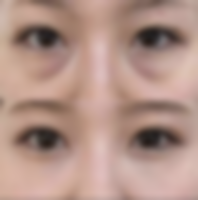 广州市第十二人民医院整形美容科项目价格