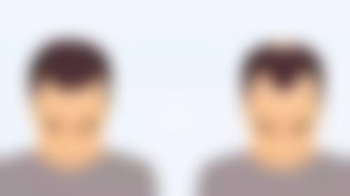 西安莎曼妃整形医疗美容医院朴俊医生口碑评价与项目分享：