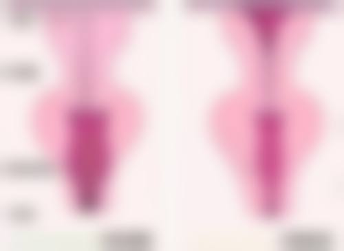 西安莎曼妃整形医疗美容医院擅长项目