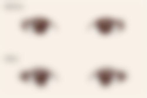 深圳瑞珠整形医院治疗反馈与口碑评价。