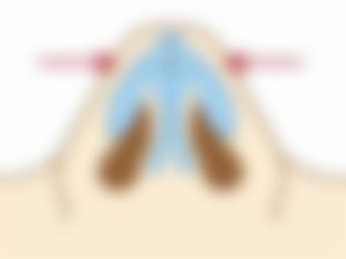 马利峰医生的擅长项目