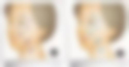 江苏百年植发连锁地理位置便于到院。