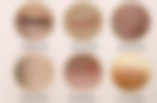 陈家欢医生技术实力展现