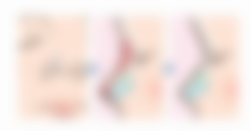 云南百媚医疗美容诊所治疗反馈与口碑评价。