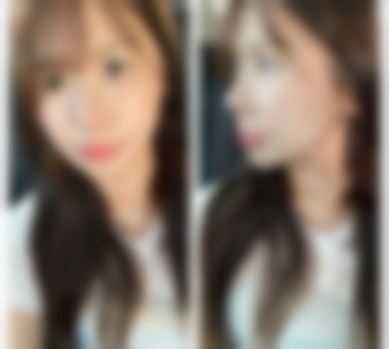 西安玺悦医疗美容门诊部口碑评价与项目分享：