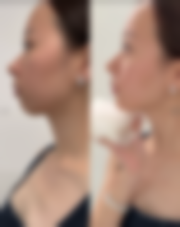 随州市中 心医院(医疗美容科)地址: