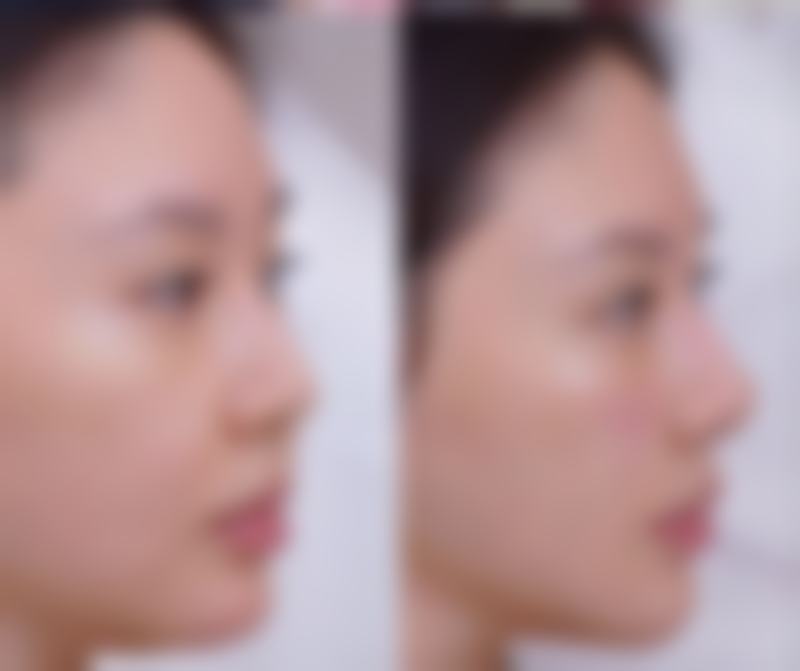 云南百媚医疗美容诊所预约挂号方式。