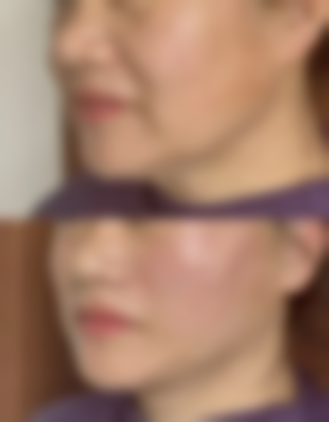 新疆星辰格林医疗美容治疗反馈与口碑评价。