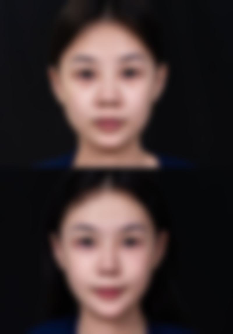 南昌青丝绾植发医疗美容诊所治疗反馈与口碑评价。