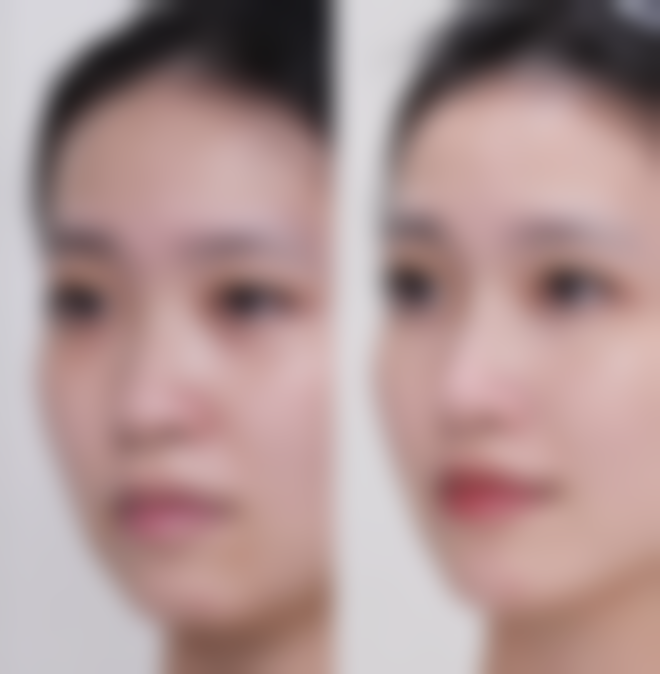 蚌埠韩美美莱医疗美容门诊部历芳医生价格收费表查询