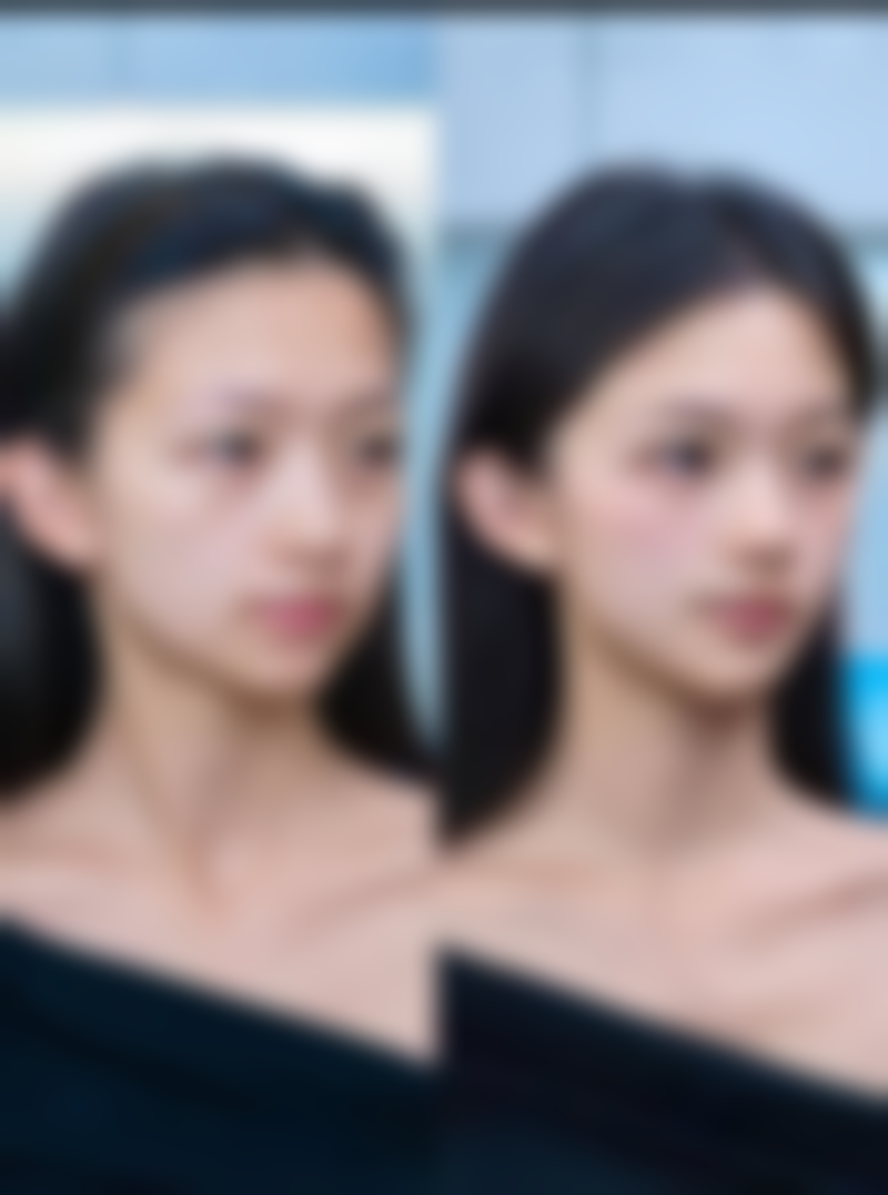 崔宇植 Noselips 整形外科（原 MVP 整形外科）如何预约挂号？