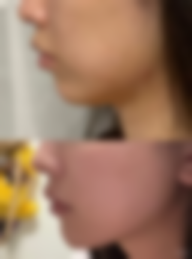 陈家欢医生技术怎么样