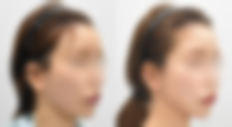 四川人民医院整形美容科擅长项目。