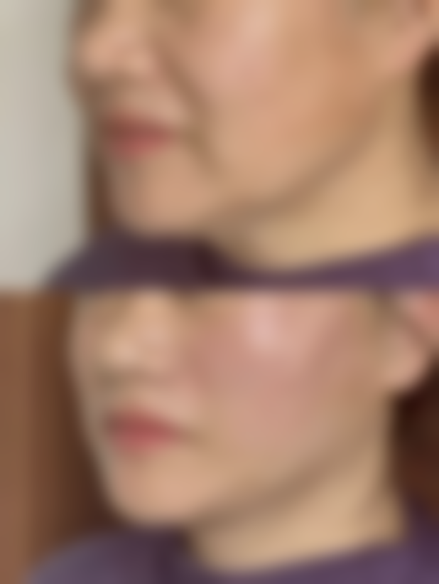 熙朵植发连锁·大兴院部预约挂号方式有哪些？