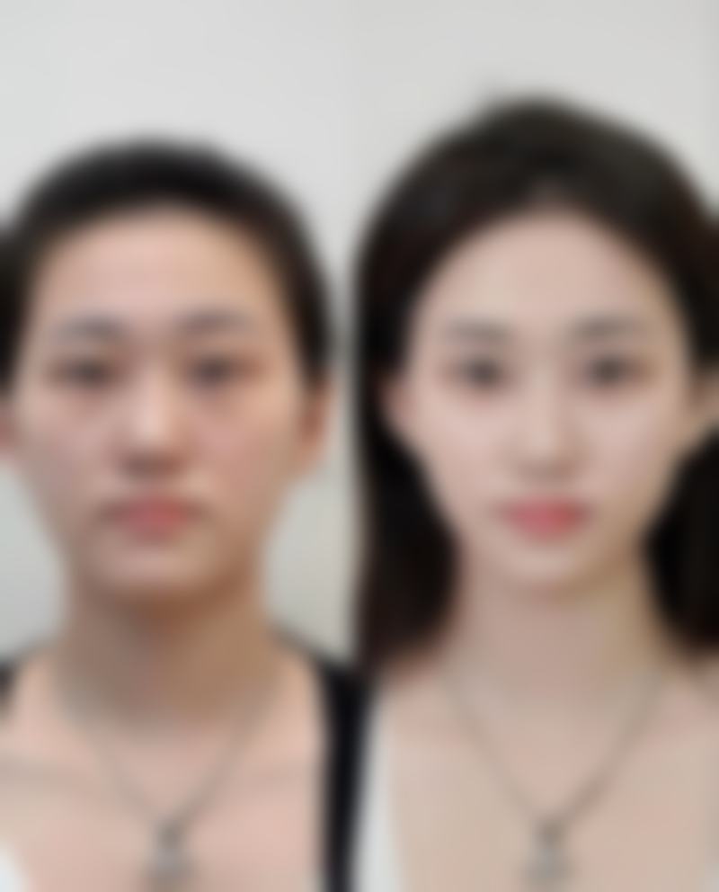 蚌埠韩美美莱医疗美容门诊部历芳医生擅长项目