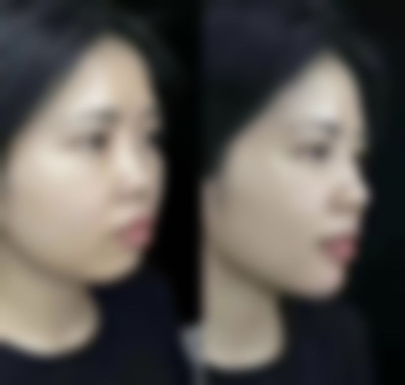 蚌埠韩美美莱医疗美容门诊部历芳医生上班时间：每天上午九点-下午六点