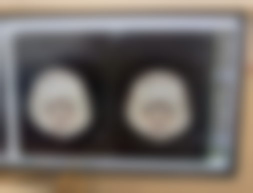 熙朵植发连锁·大兴院部地理位置便于到院吗？