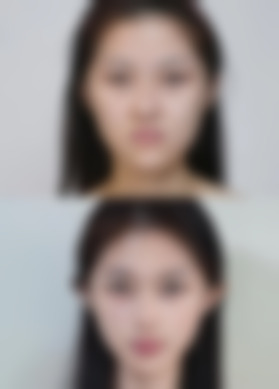 清远华美整形美容门诊部擅长项目