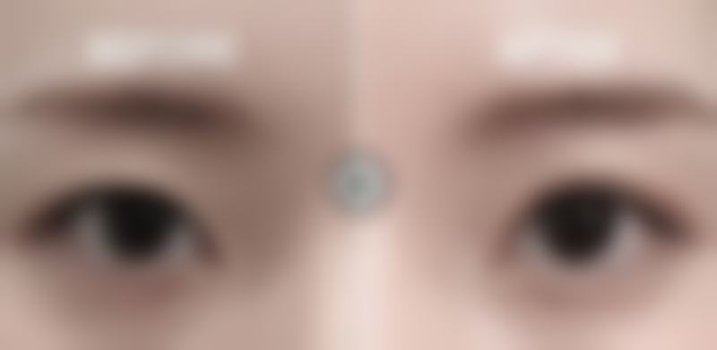 陈泽医生擅长项目