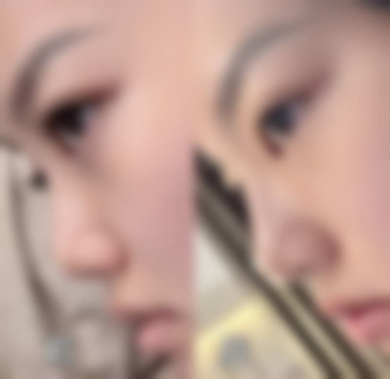 崔宇植 Noselips 整形外科（原 MVP 整形外科）门诊营业时间。