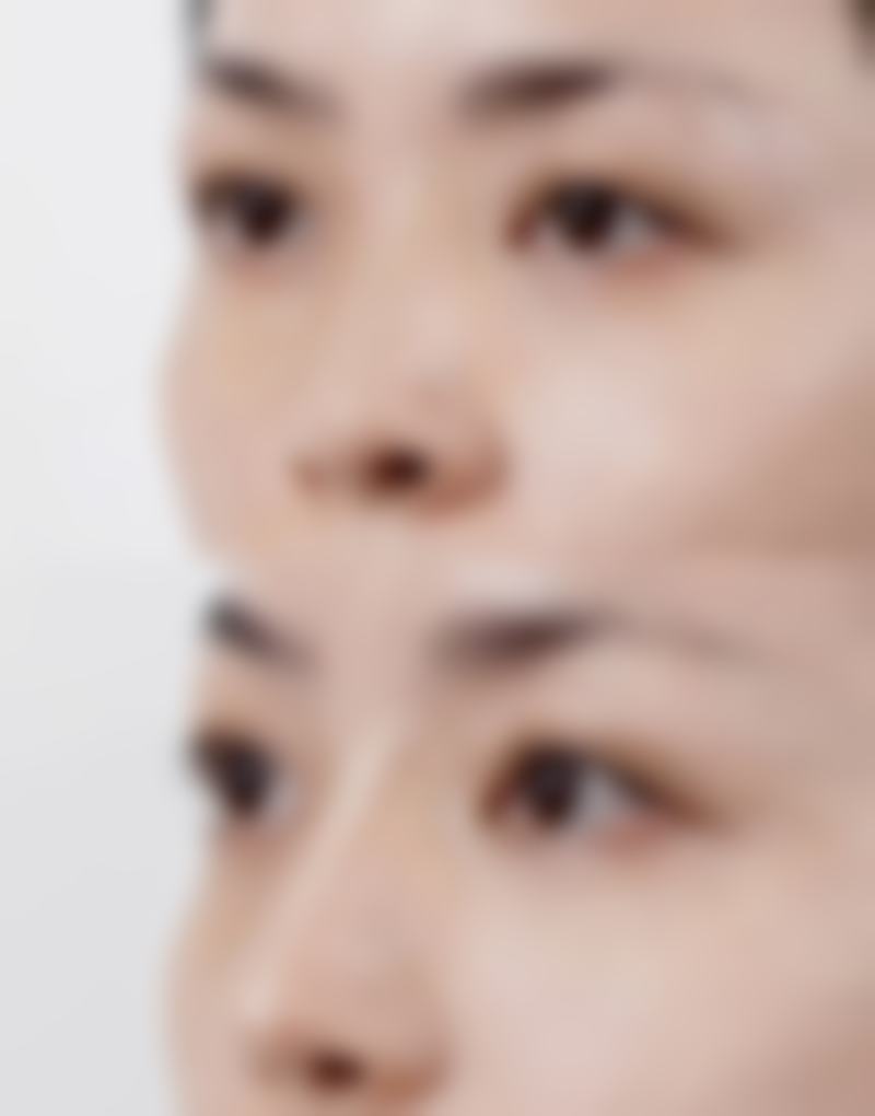 贵阳丽肤皮肤病医院口碑评价与项目分享：