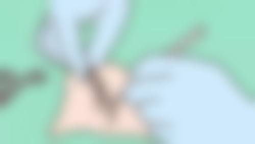 洛阳一览芳华医疗美容门诊部马利峰医生口碑评价与项目分享：