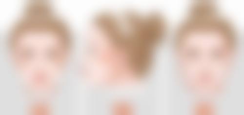 陈家欢医生技术实力展现