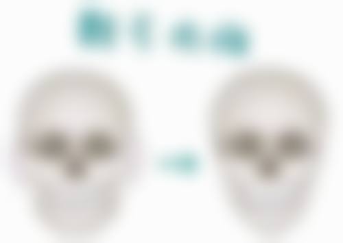 西安莎曼妃整形医疗美容医院朴俊医生预约挂号