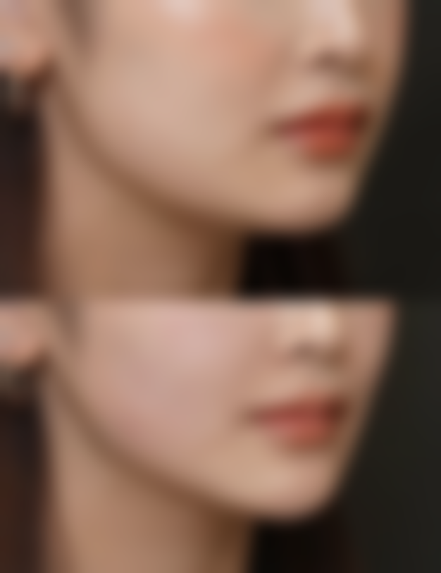 蚌埠韩美美莱医疗美容门诊部擅长项目