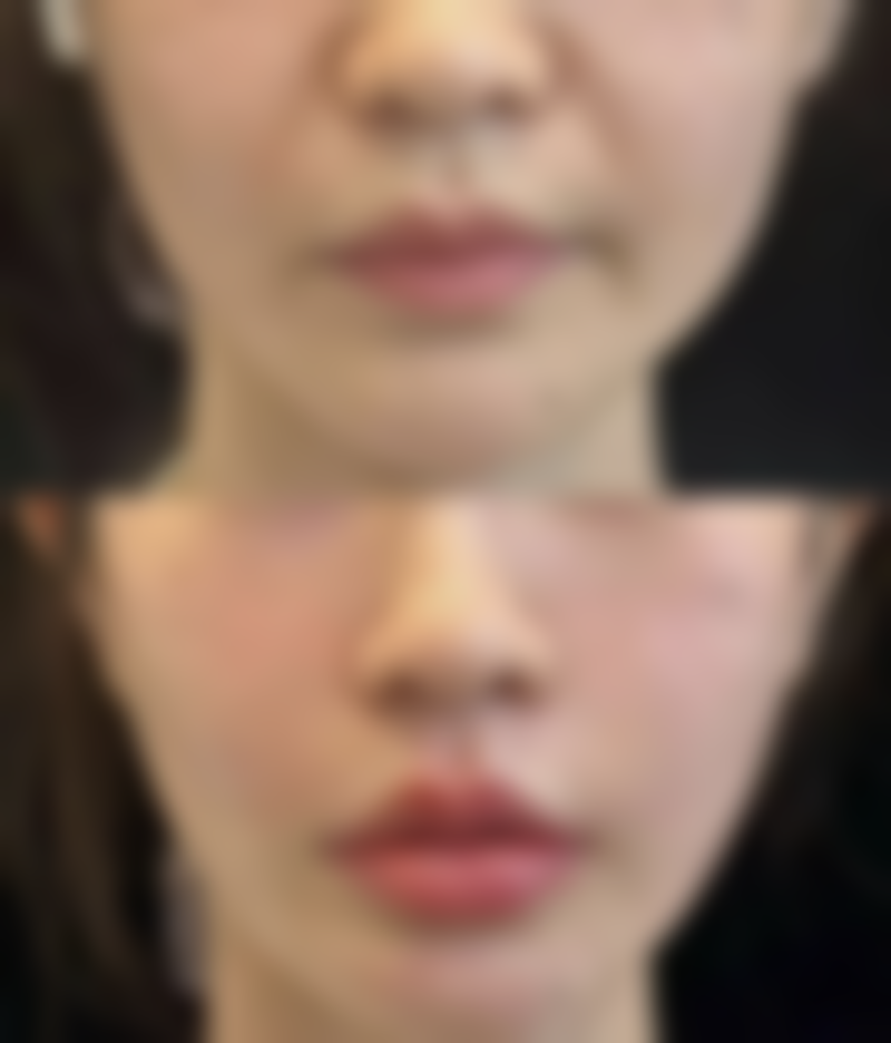 广州市第十二人民医院整形美容科口碑评价