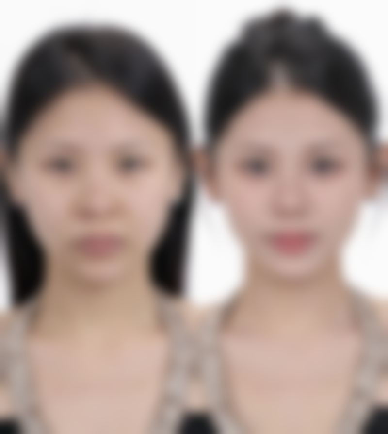 唐娟医生技术与实力体现